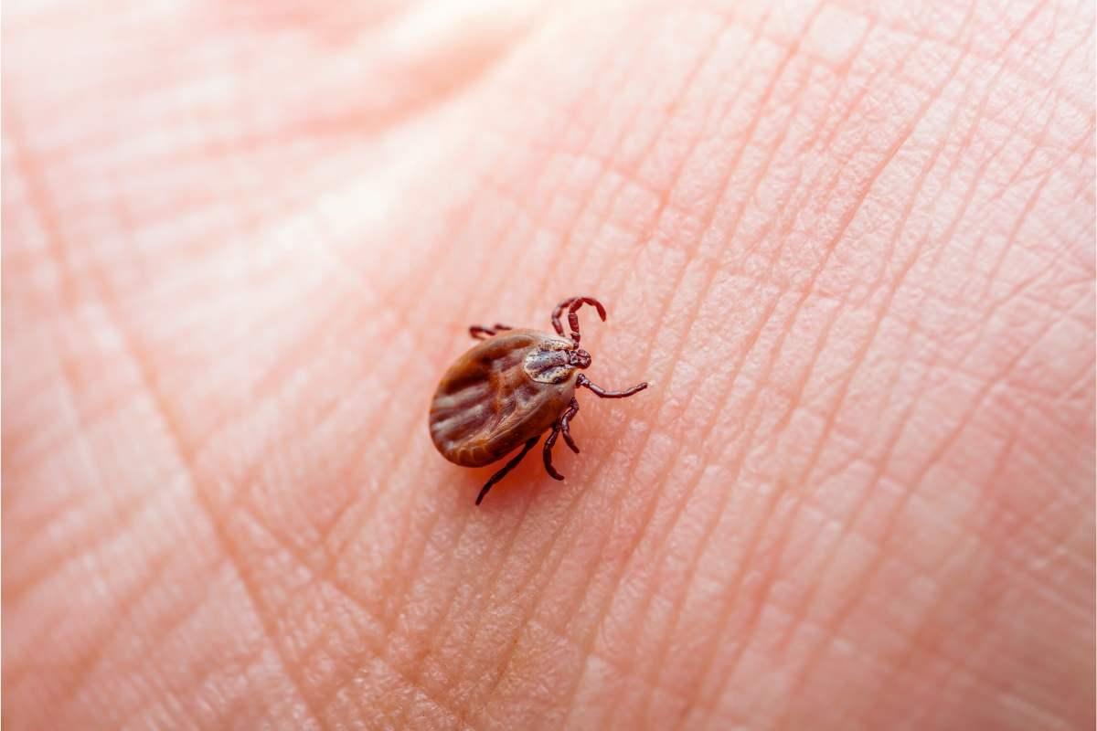 Lyme, la malattia che ha colpito Justin Timberlake